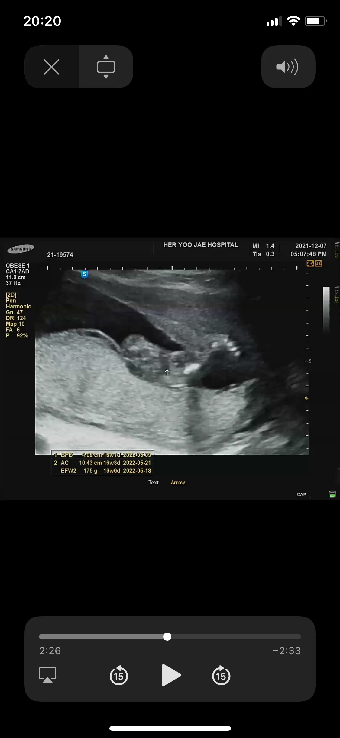 16w6d 🍑딸맘🍑🤍🤍