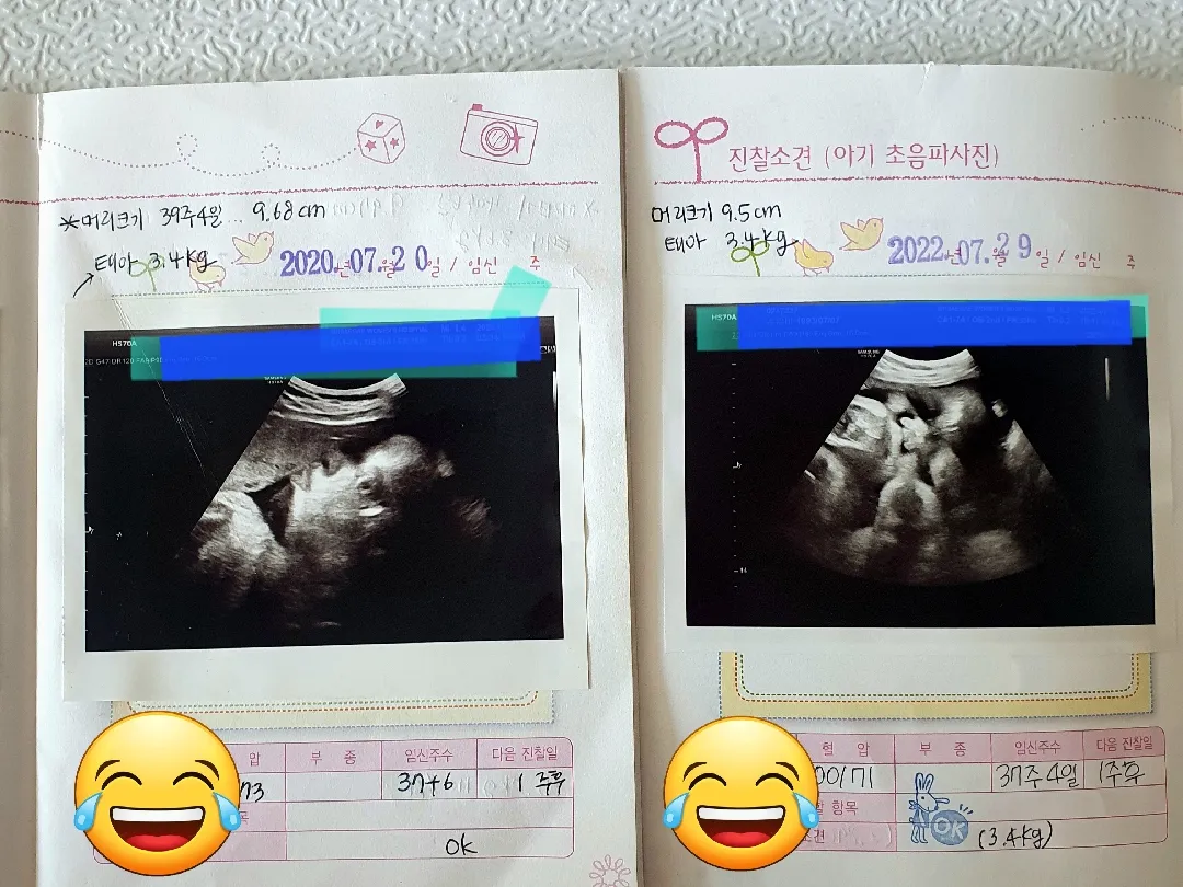 첫째 둘째 평행이론..