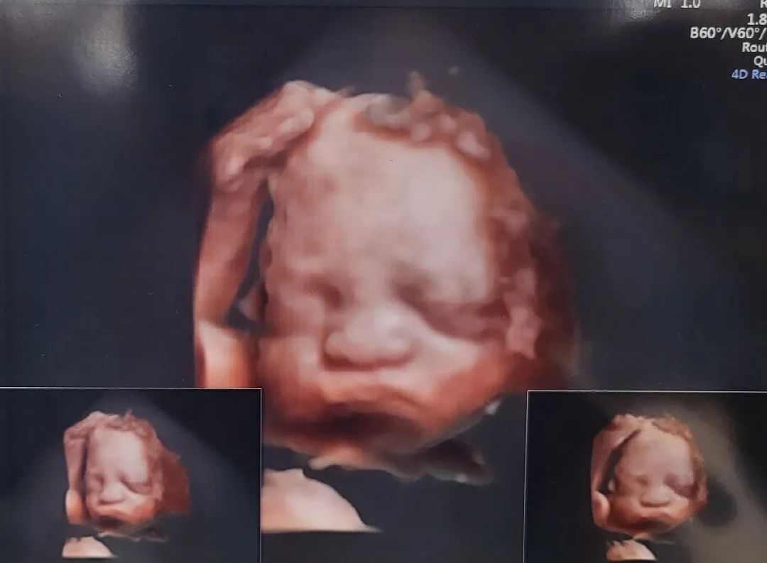 우리애기초음파찍었어요~~👶