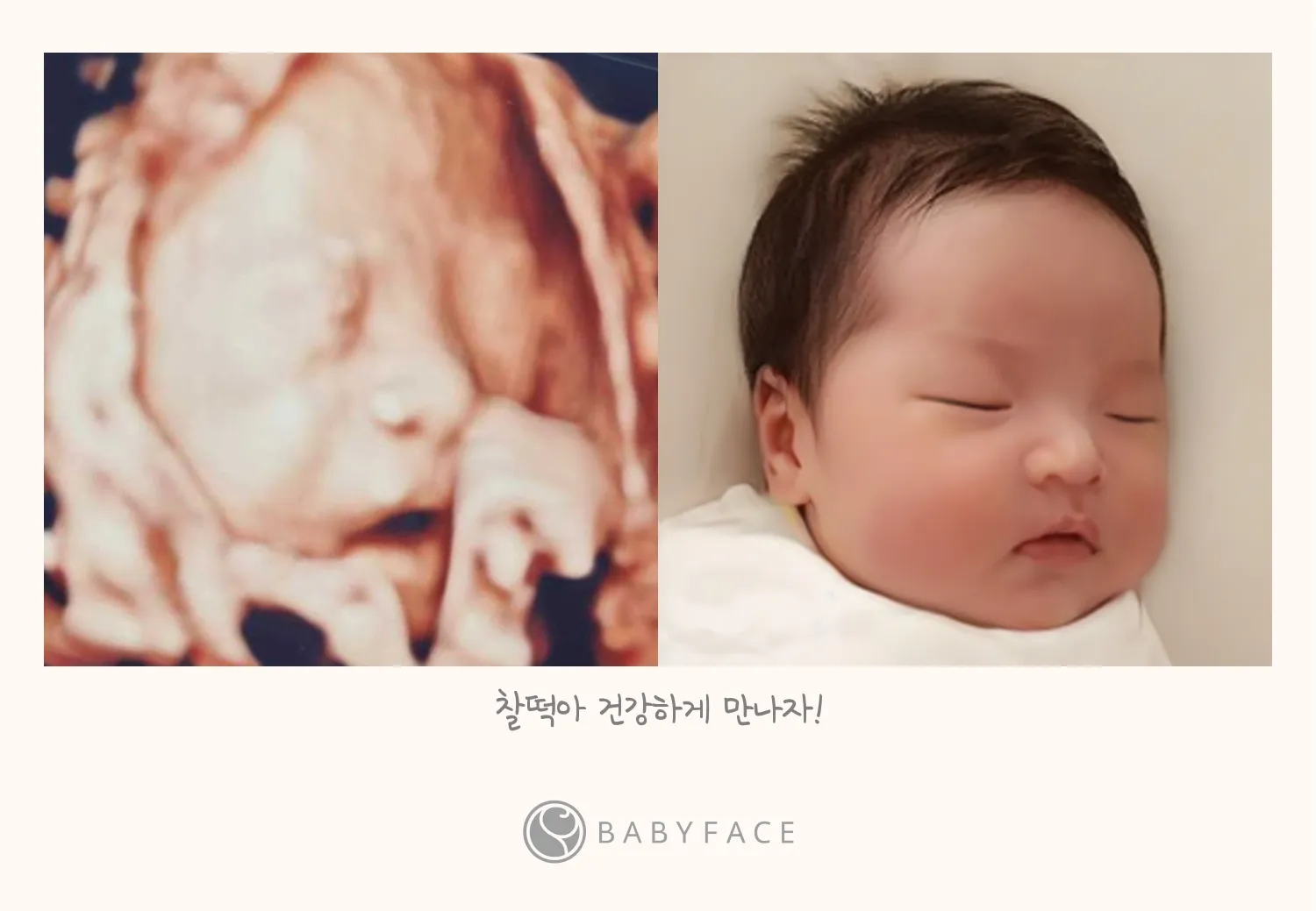 고민하다 했는데 잘한거 같아요~!