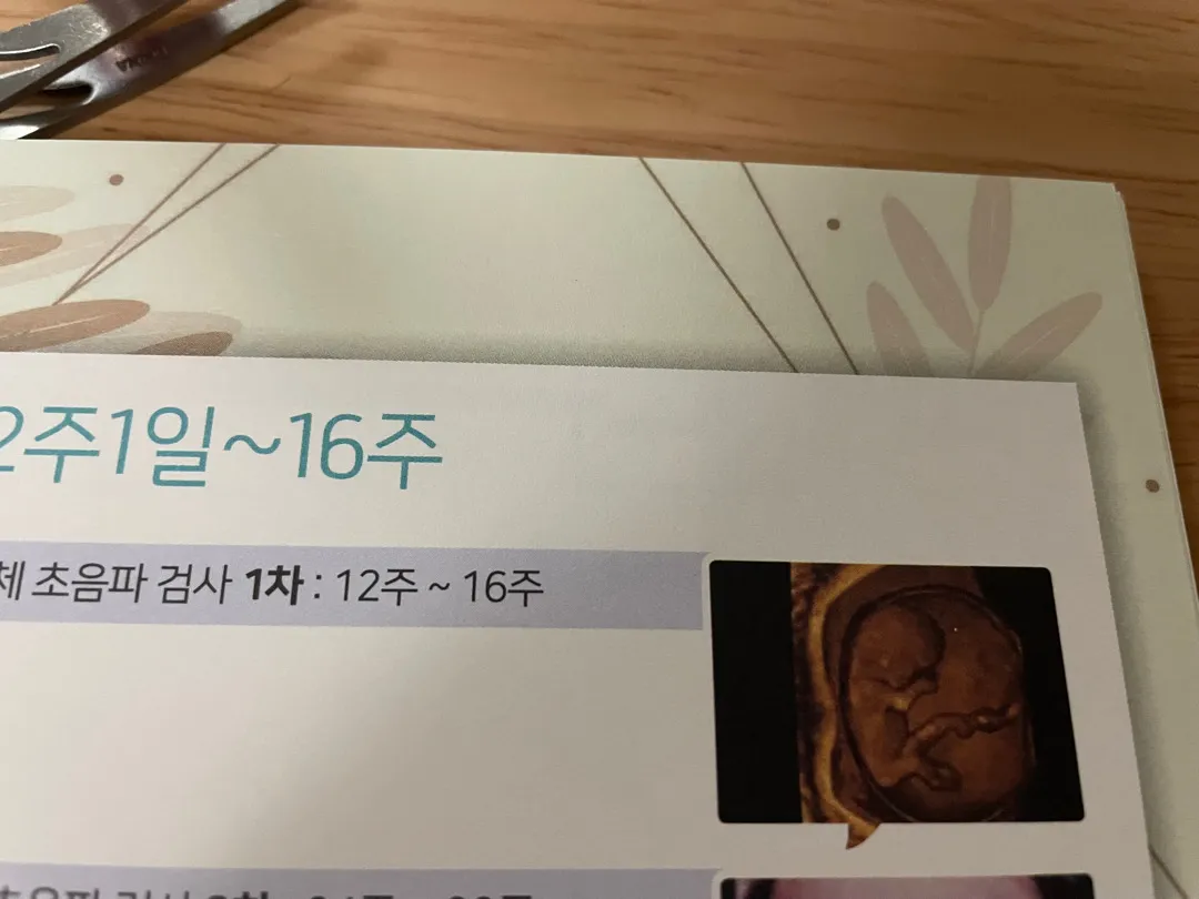 1차입체초음파는언제하는건가요?