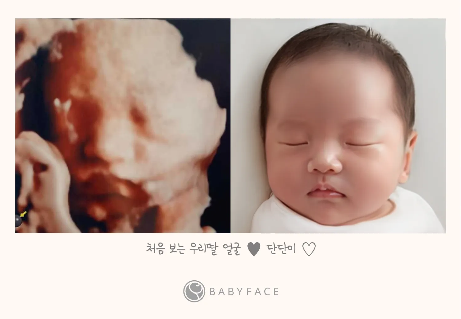 베이비페이스 만족이요^^