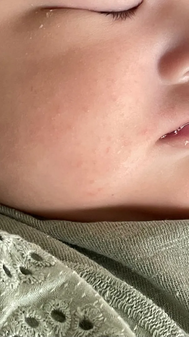 이거 침독 맞나요?