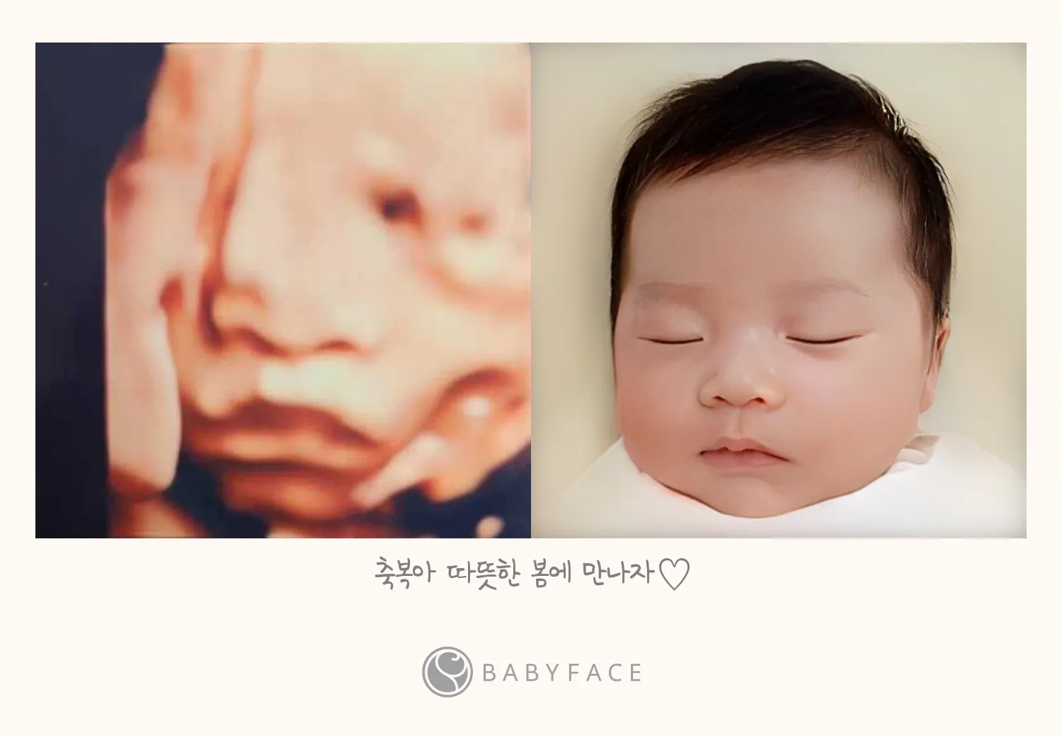입초 베이비 페이스했어요!