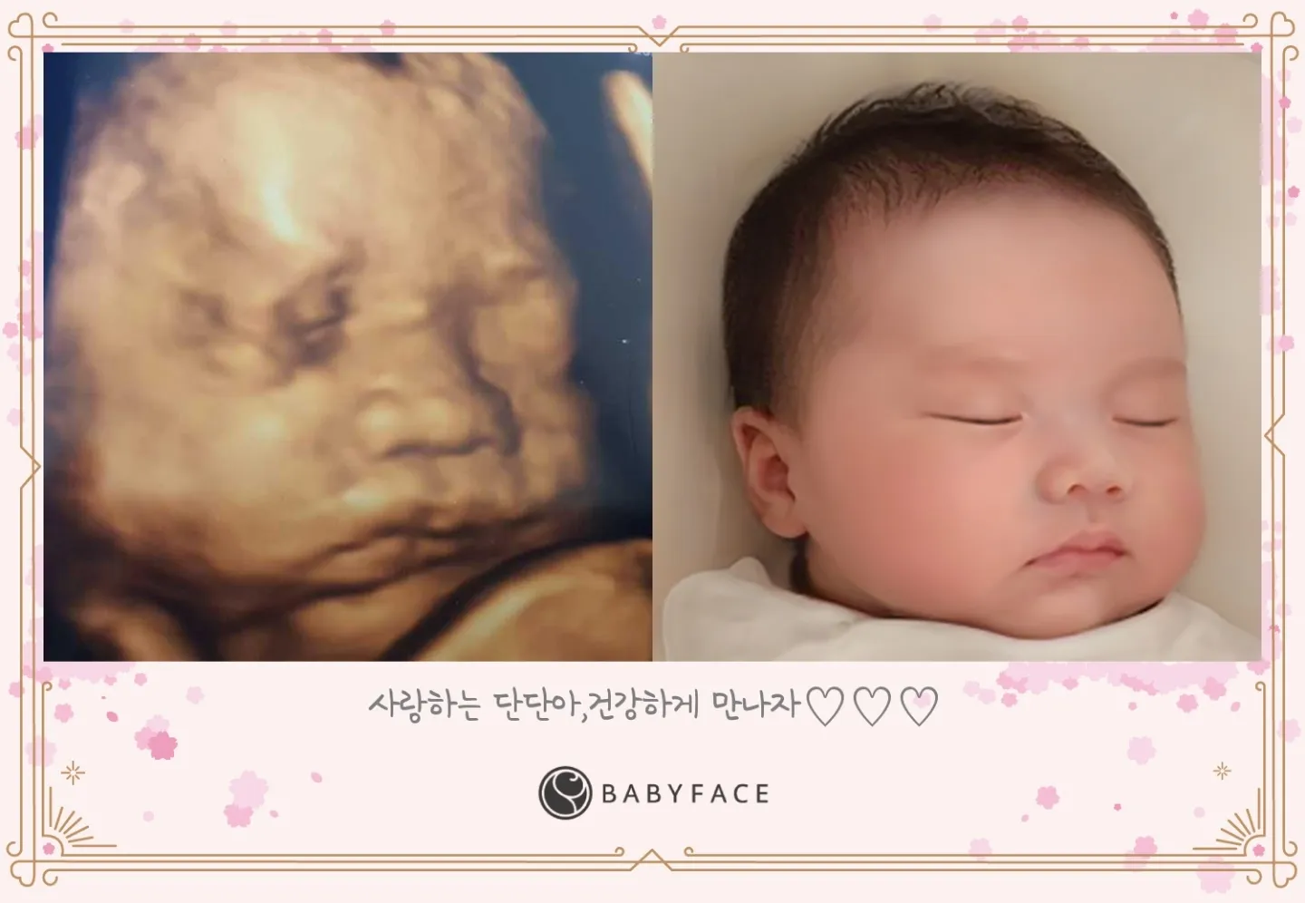 베이비페이스했는데 어떤가요?
