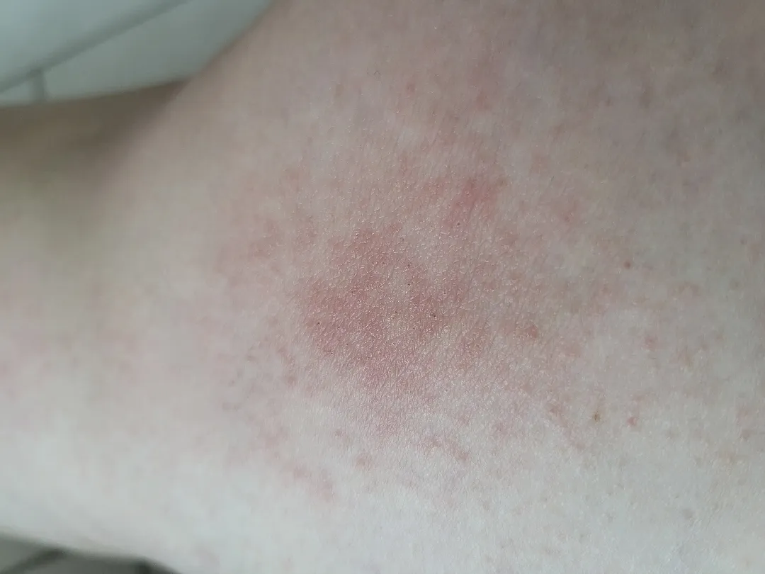 피부 한번 봐주세요