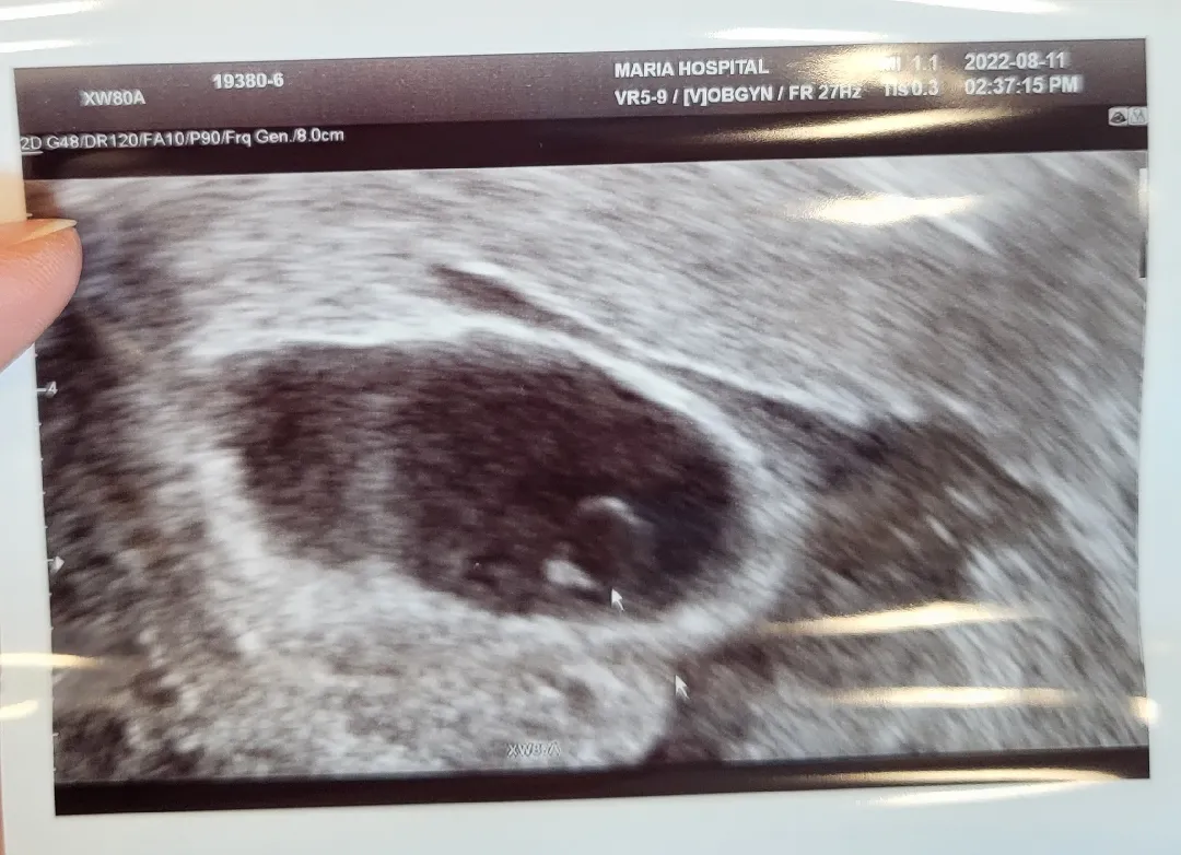 community post image