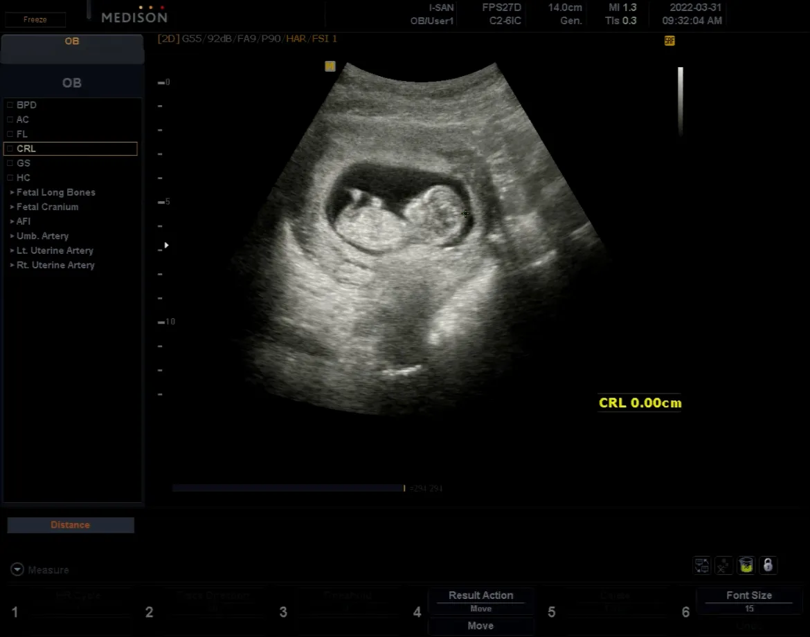 community post image