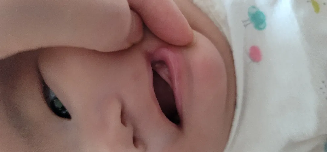 입안에 동그란거