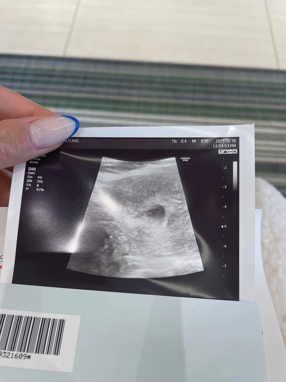 오늘 첫초음파 5주6일/ 임신지원금 다들 언제 등록하시나요?