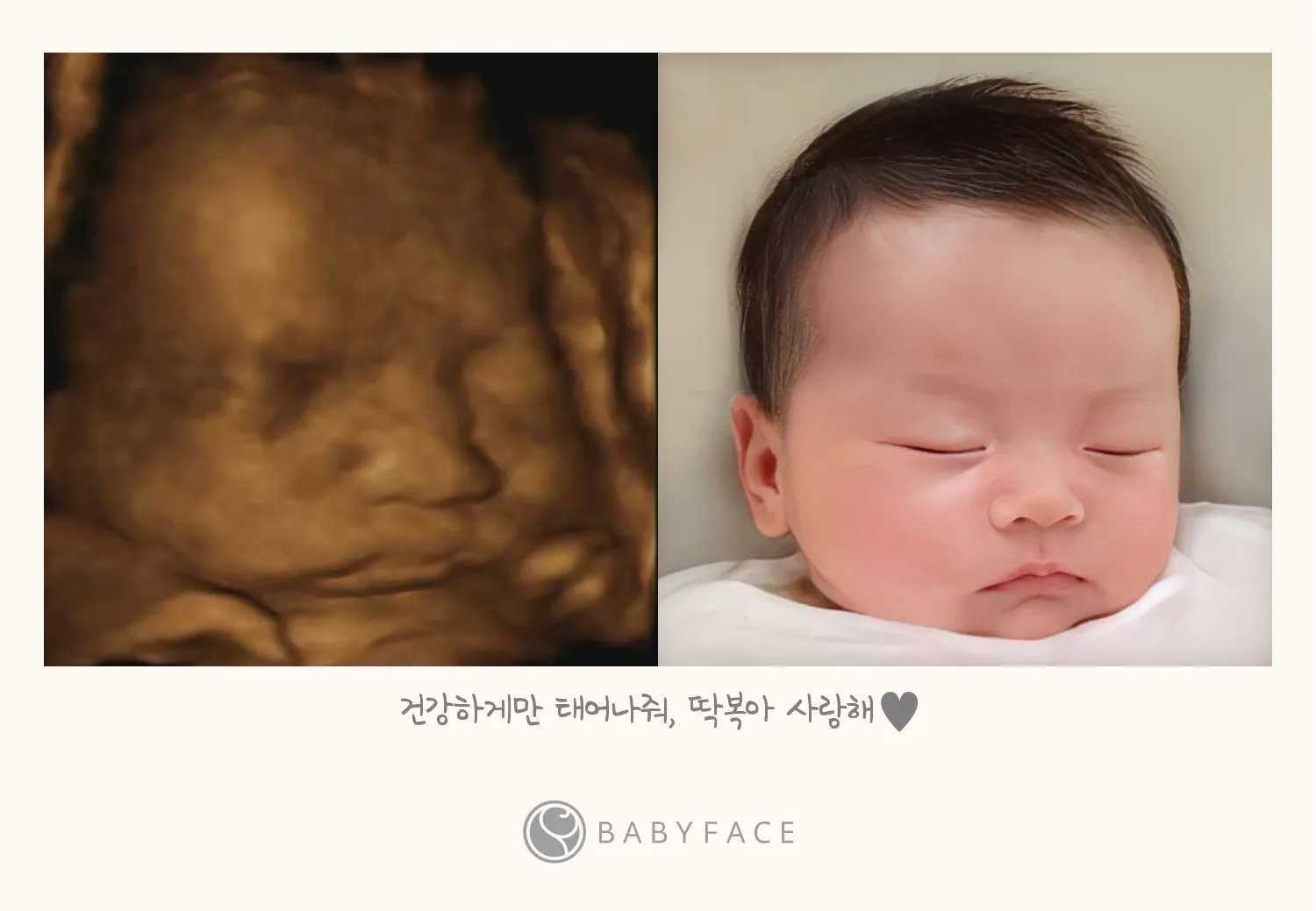 베이비페이스 했어요!