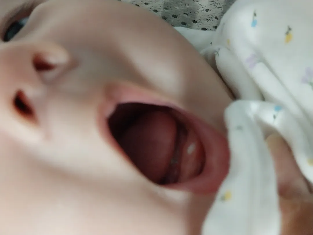 이거 이빨인가요?