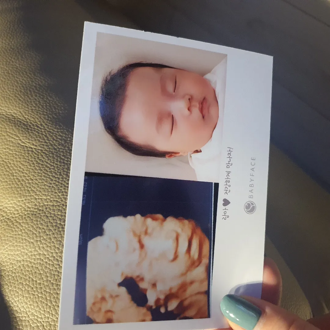 저도 드뎌 베이비페이스했어요♡