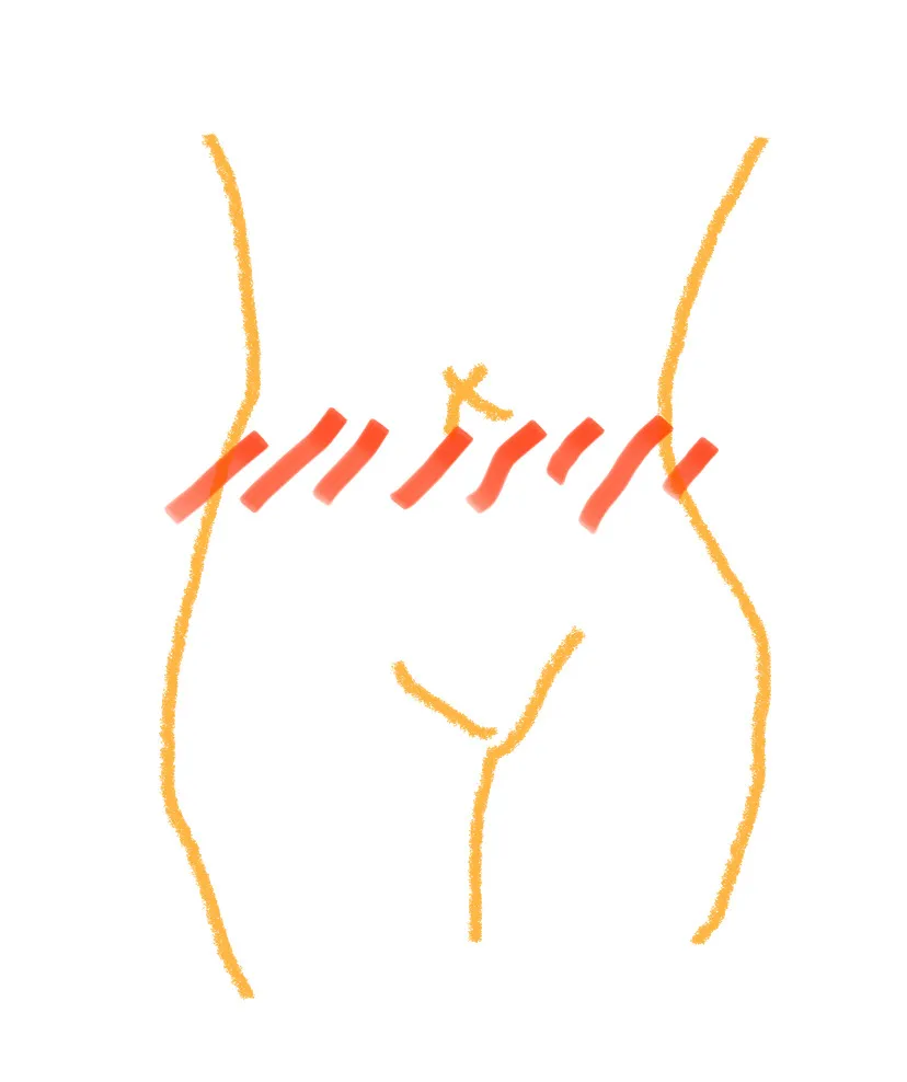 community post image