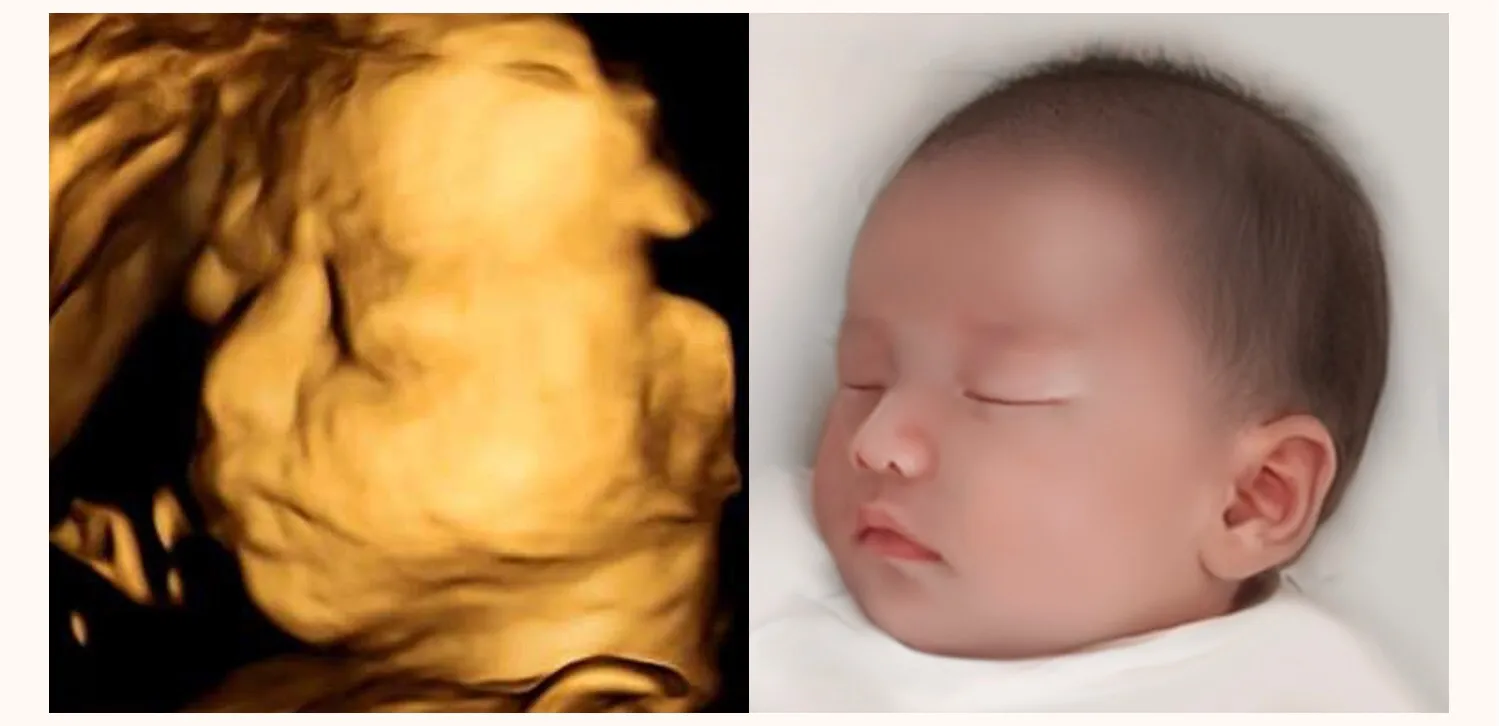 정밀촘파받고 베이비페이스 했어요♥️