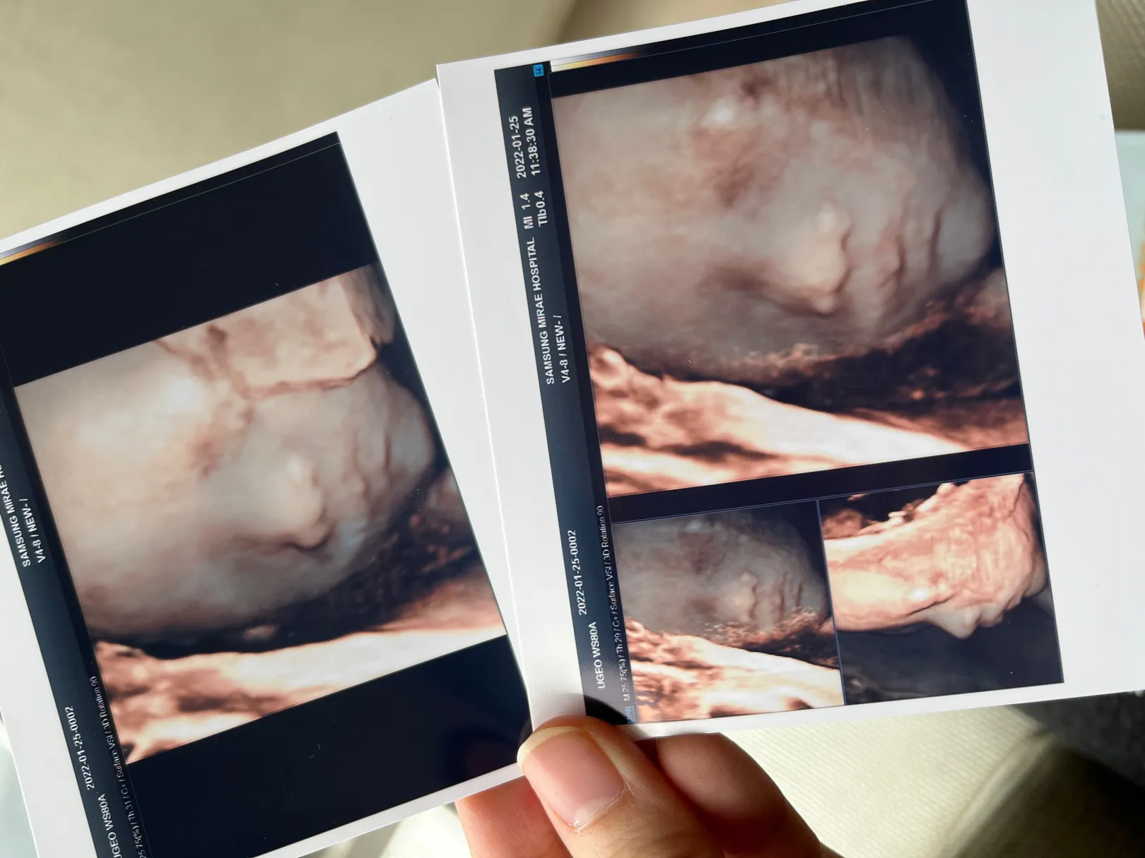 딸랑구👶🏻입초 보고 왔어요