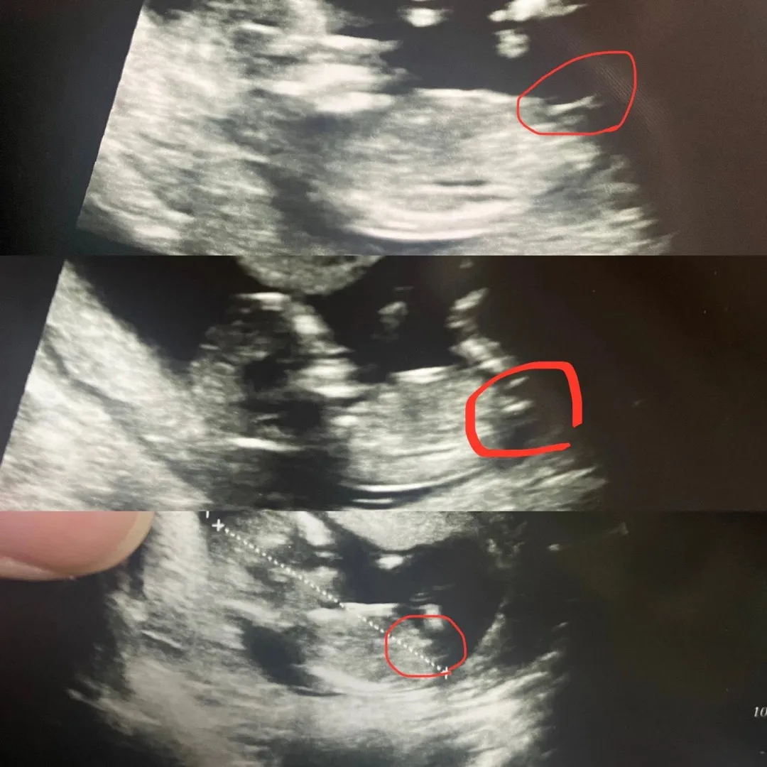 아들일까요 딸일까요? 추측하는 설렘도 좋네요 ㅎㅎㅎ