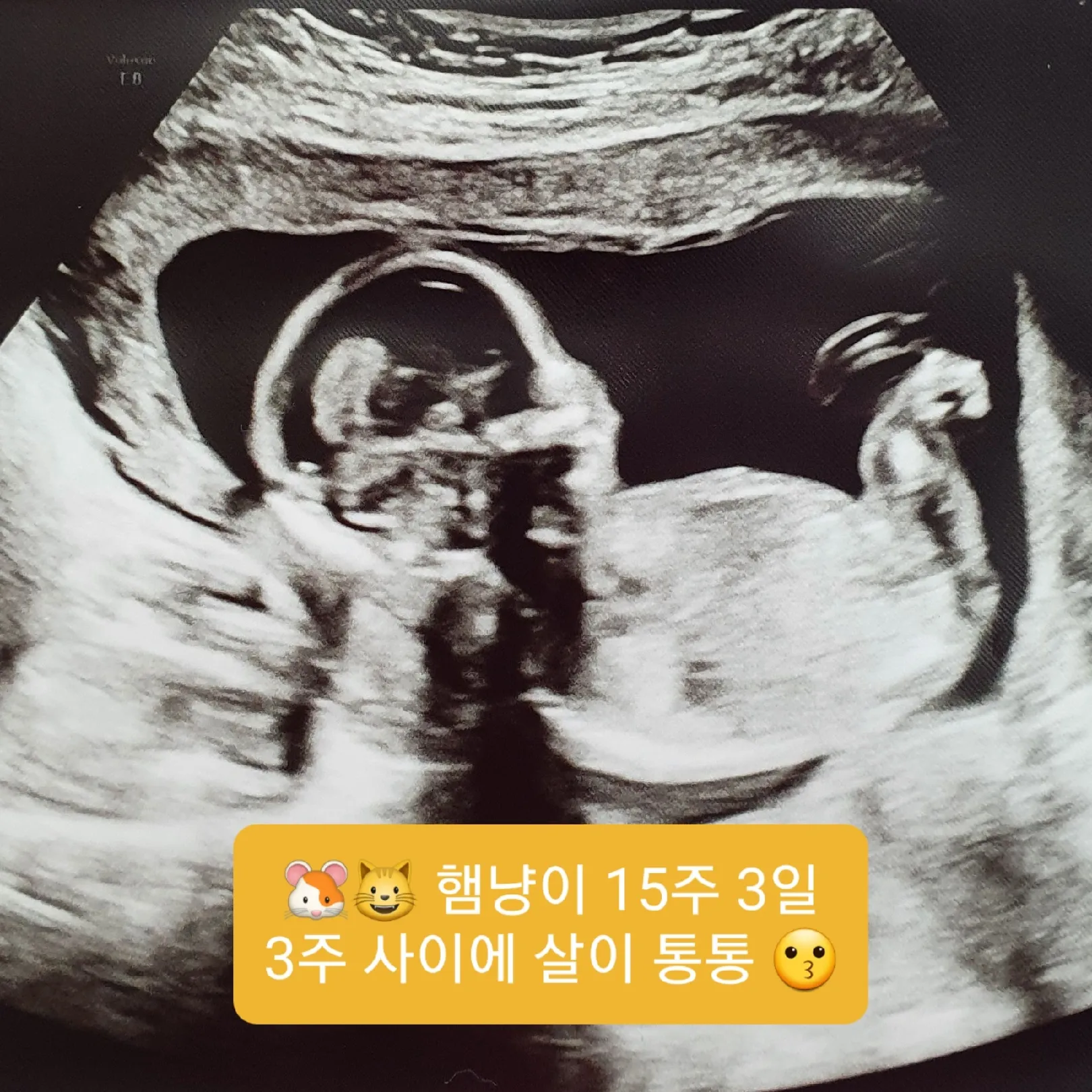 방금 태동 느꼈어요!