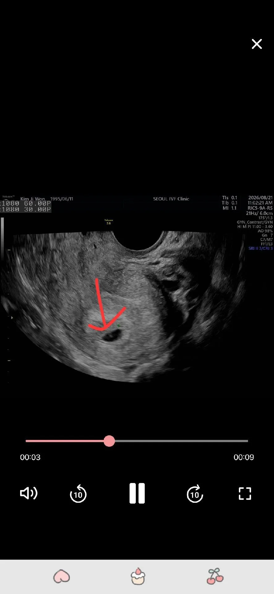 5주1일차 초음파아기집보고왔는데봐주세용