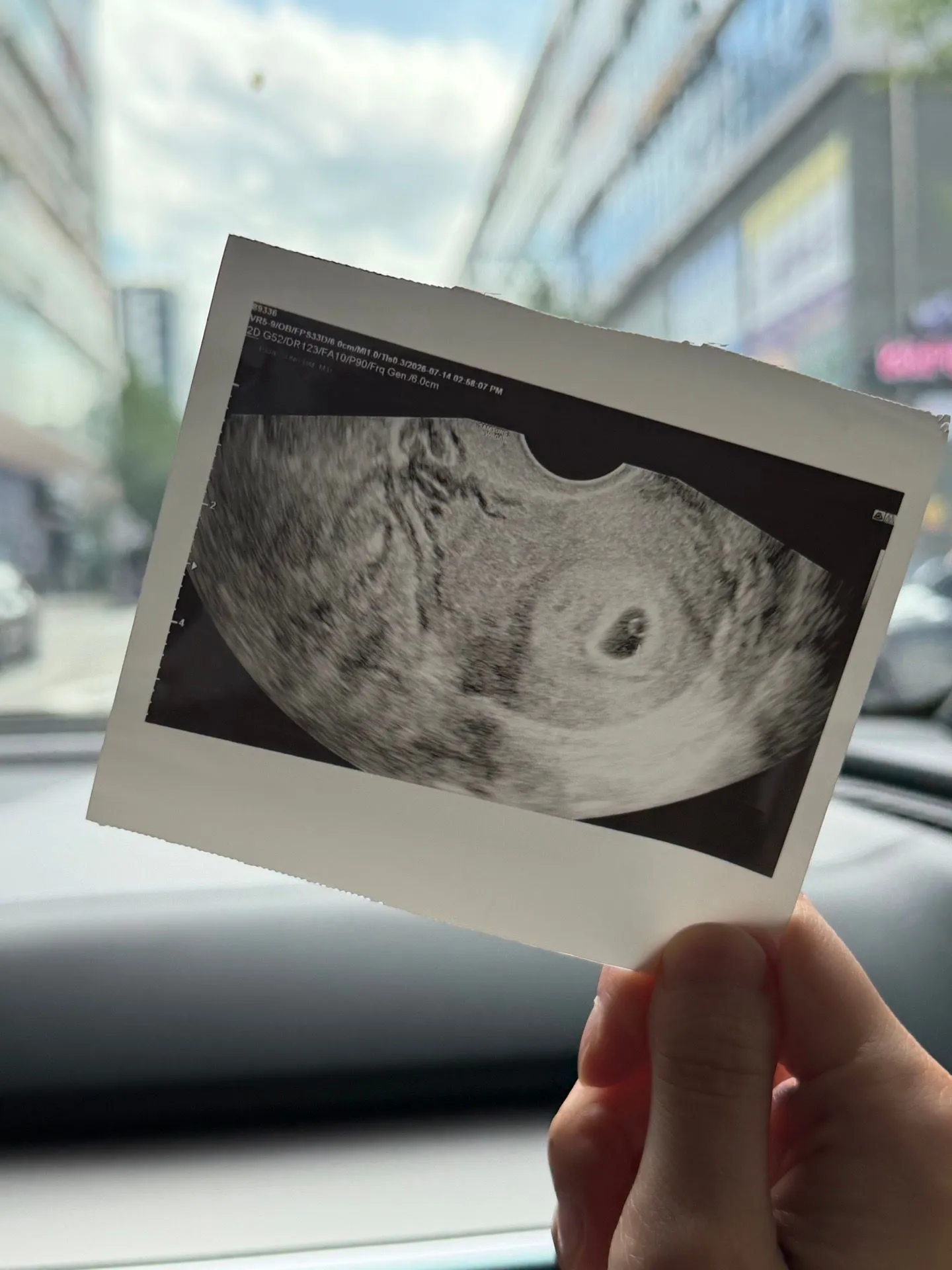 5주 5일 난황보고 왔는데 아기는 언제 볼수 있을까요?