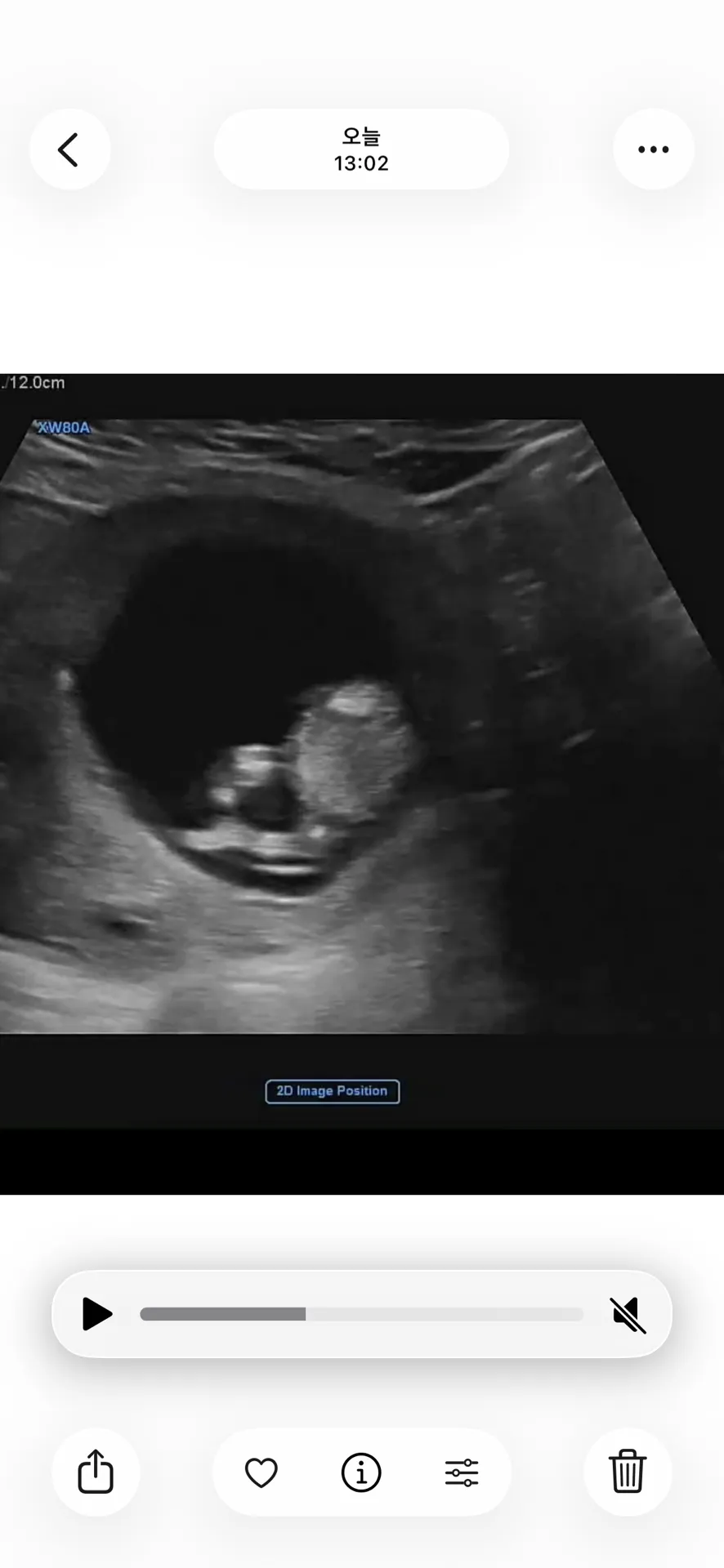 (12주2일) 초음파 성별 예측해주세요! 1