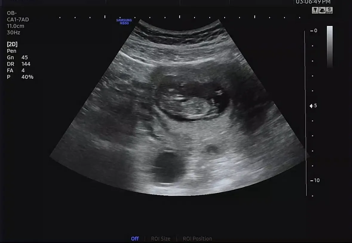 각도법..봐주실 분 계실까용? 3