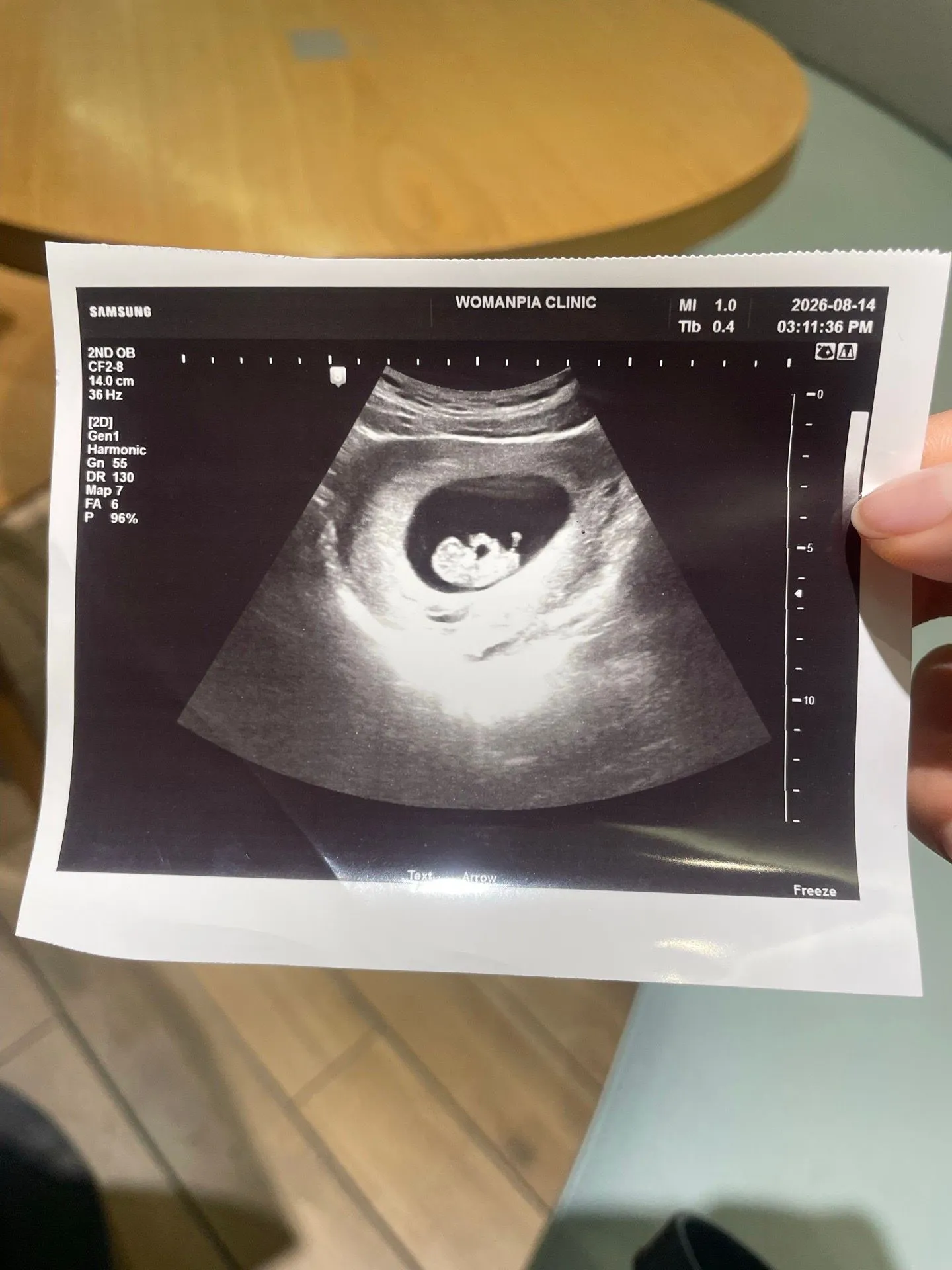 초음파 9주4일 사진으로 성별 알 수 있나요?