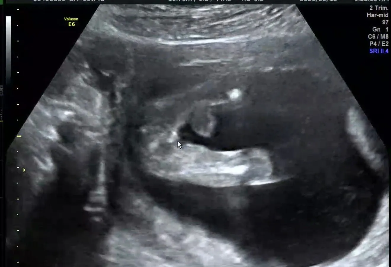 16주차 4일 성별질문 1