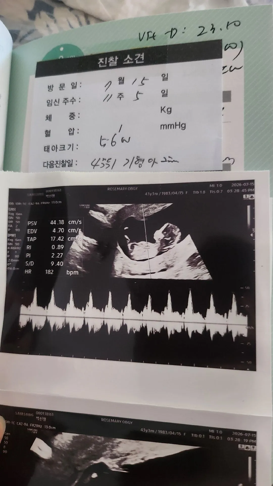 셋째임신 13년만이라 모르겠어요ㅎ 3