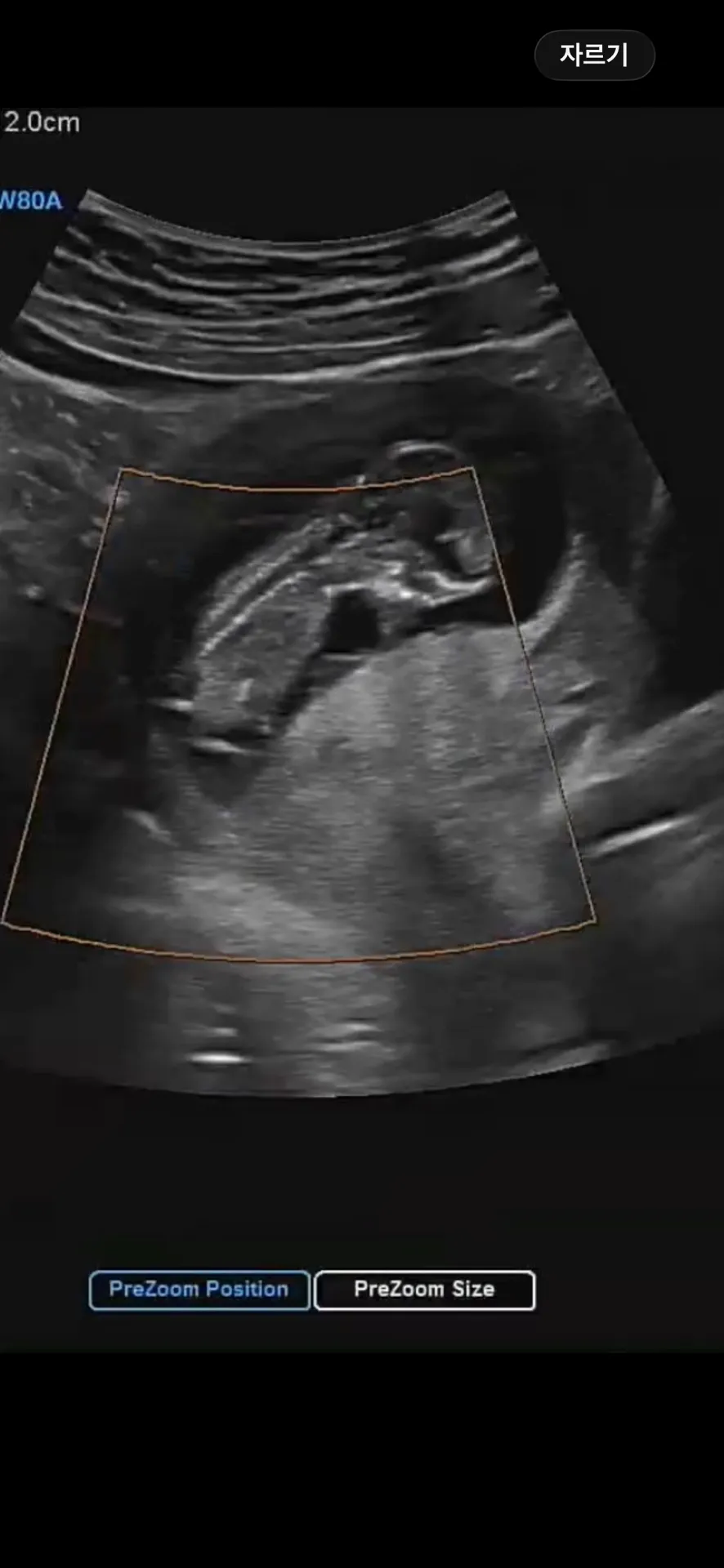 (12주2일) 초음파 성별 예측해주세요! 3