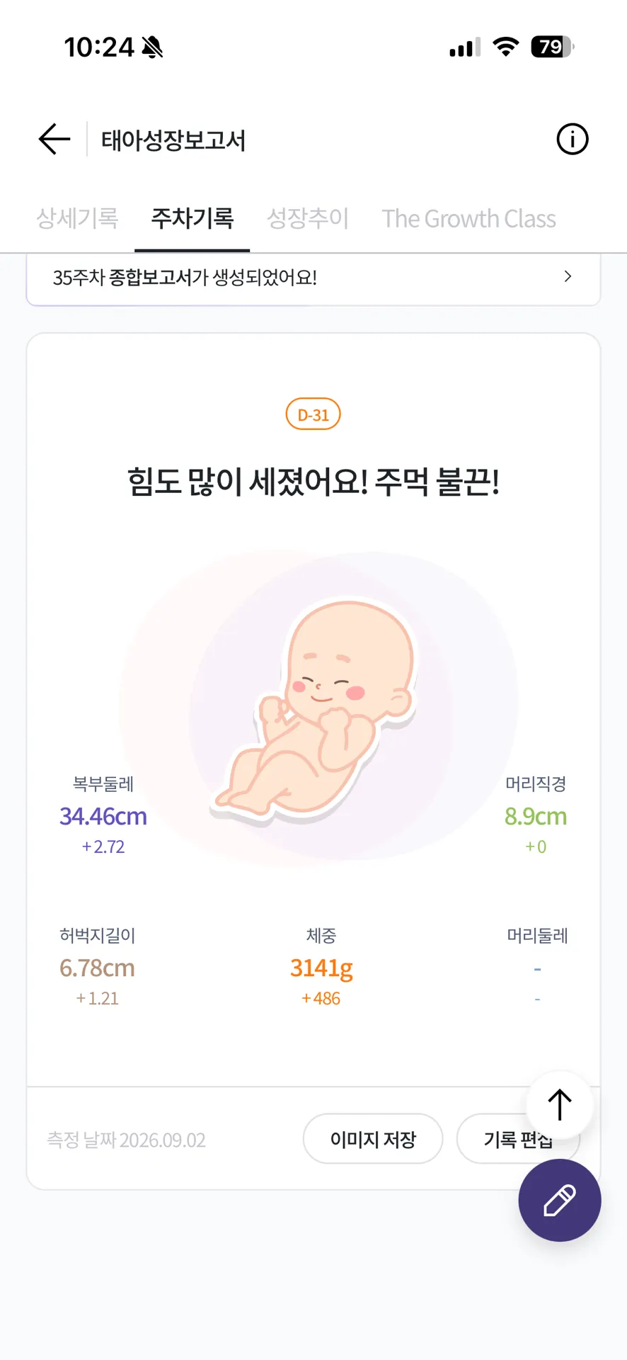 자분 제왕 뭘해야할까요 도와줘요 ㅠㅠ