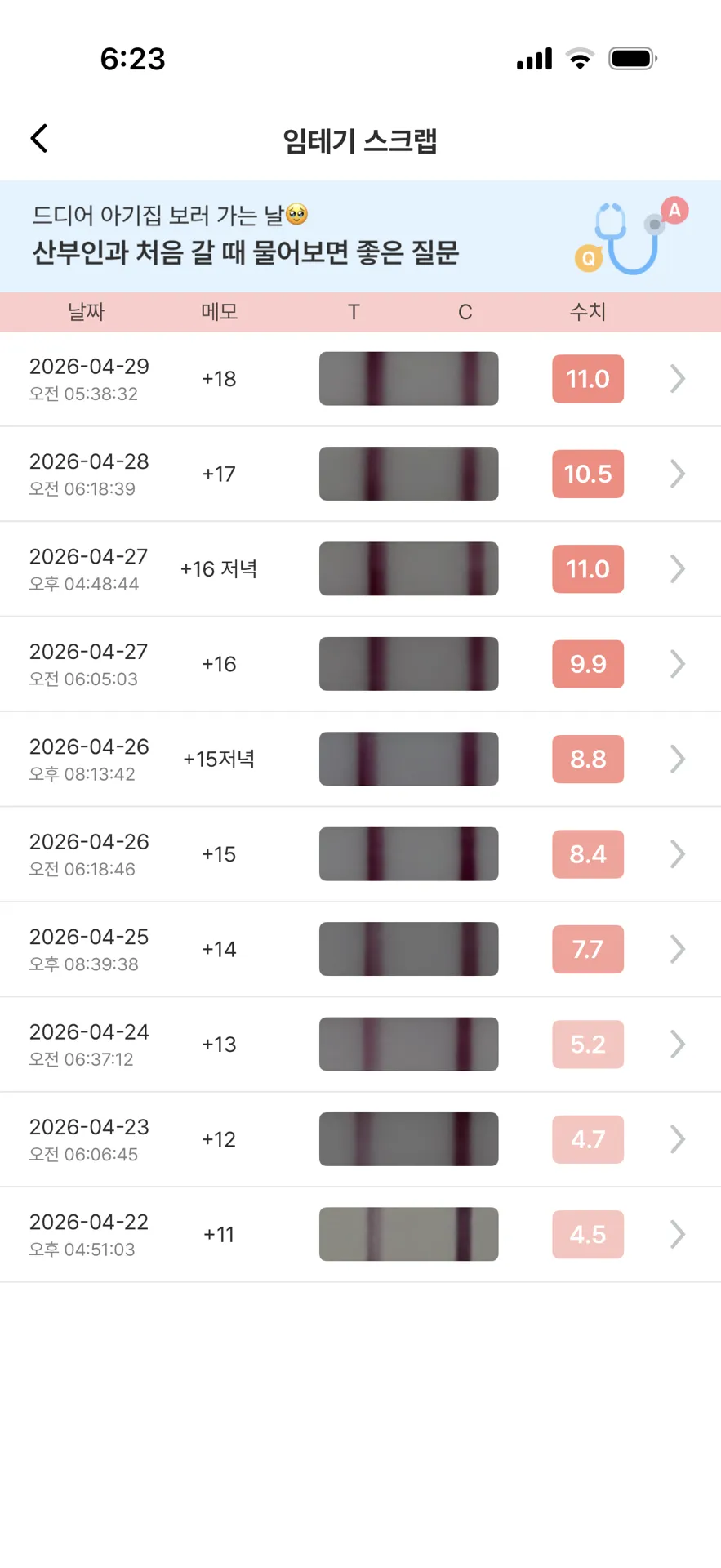 마미들 내일 아기집 볼수있을까용 1