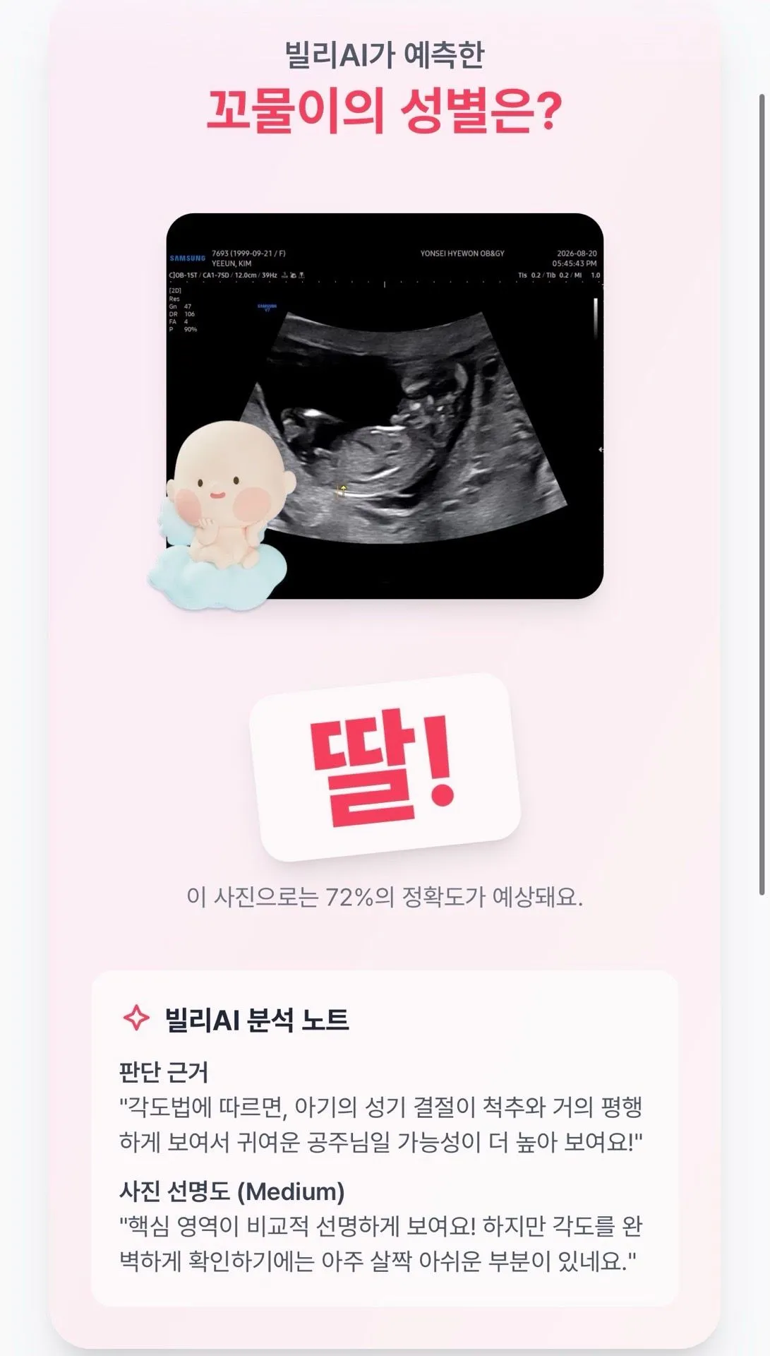 빌리 AI 성별 예측 대부분 맞나요?!