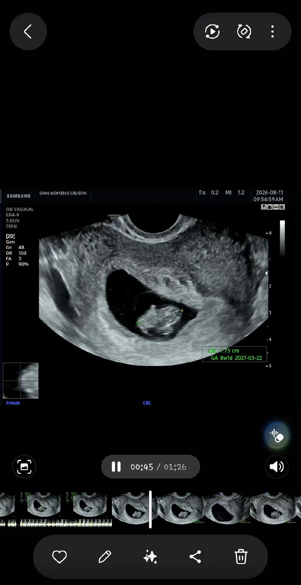 9주1일차 오늘 초음파로 젤리곰 보고 왔는데요 팔다리가 다 생겼다네요 근데요 3월 15일이 예정일이였는데 22일로 바뀌었네요