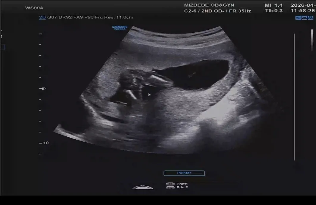 16주 성별 봐주세용!! 1