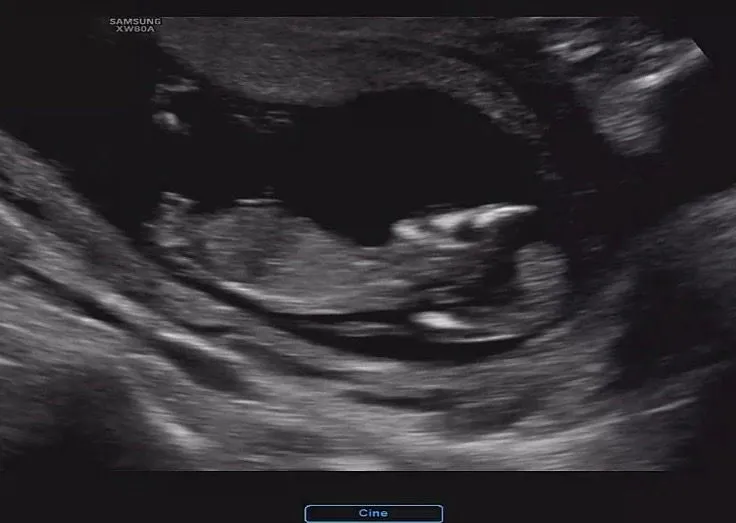 각도법 잘보시는뷴!!! 각도법 부탁드랴요🫶🏻👶🏻 2