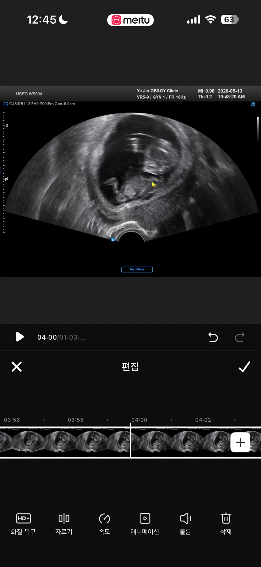 아들같지요????!!!! 12주 촘파 투표해주세요💖 2