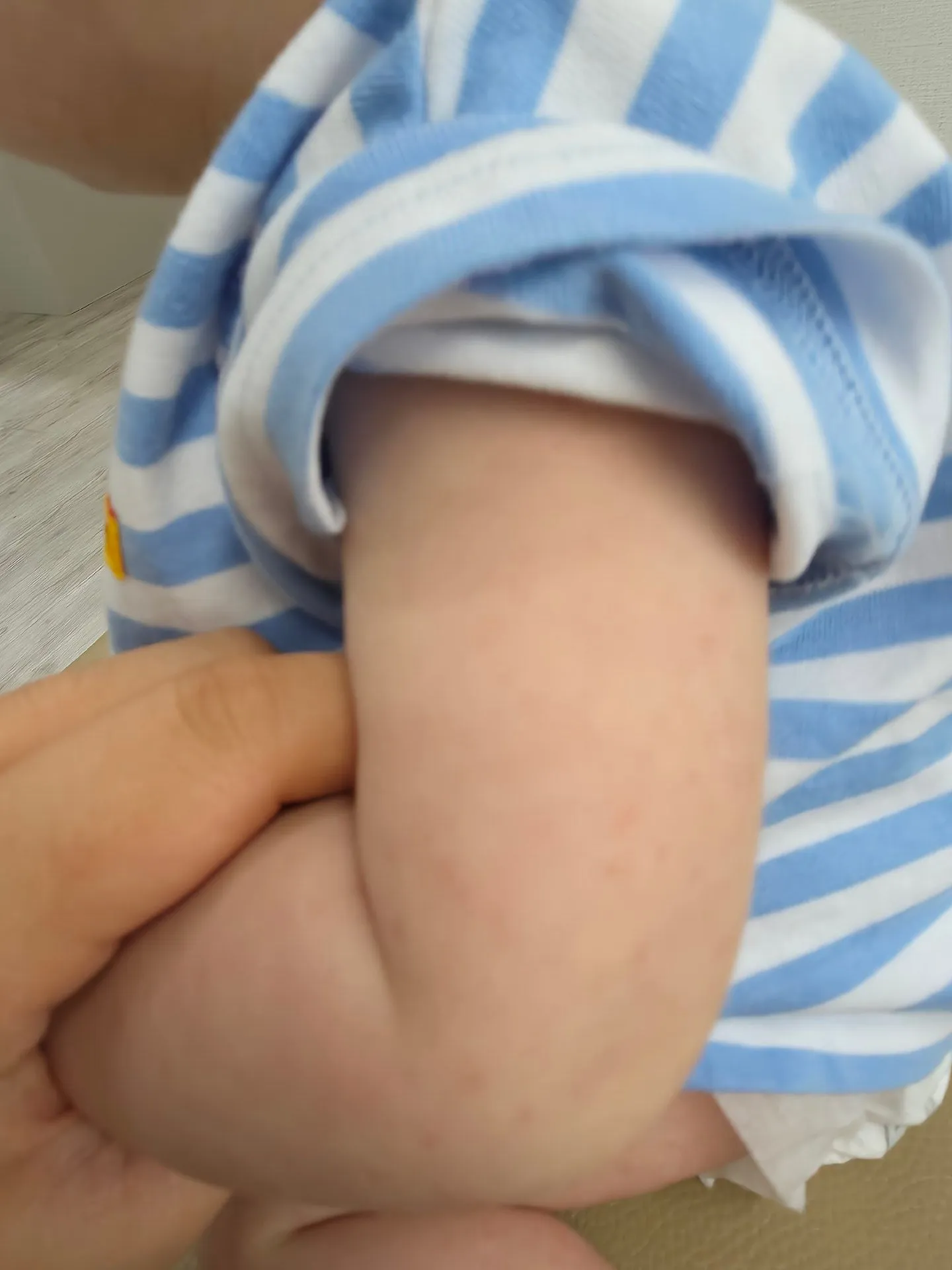 땀띠? 수족구? 3