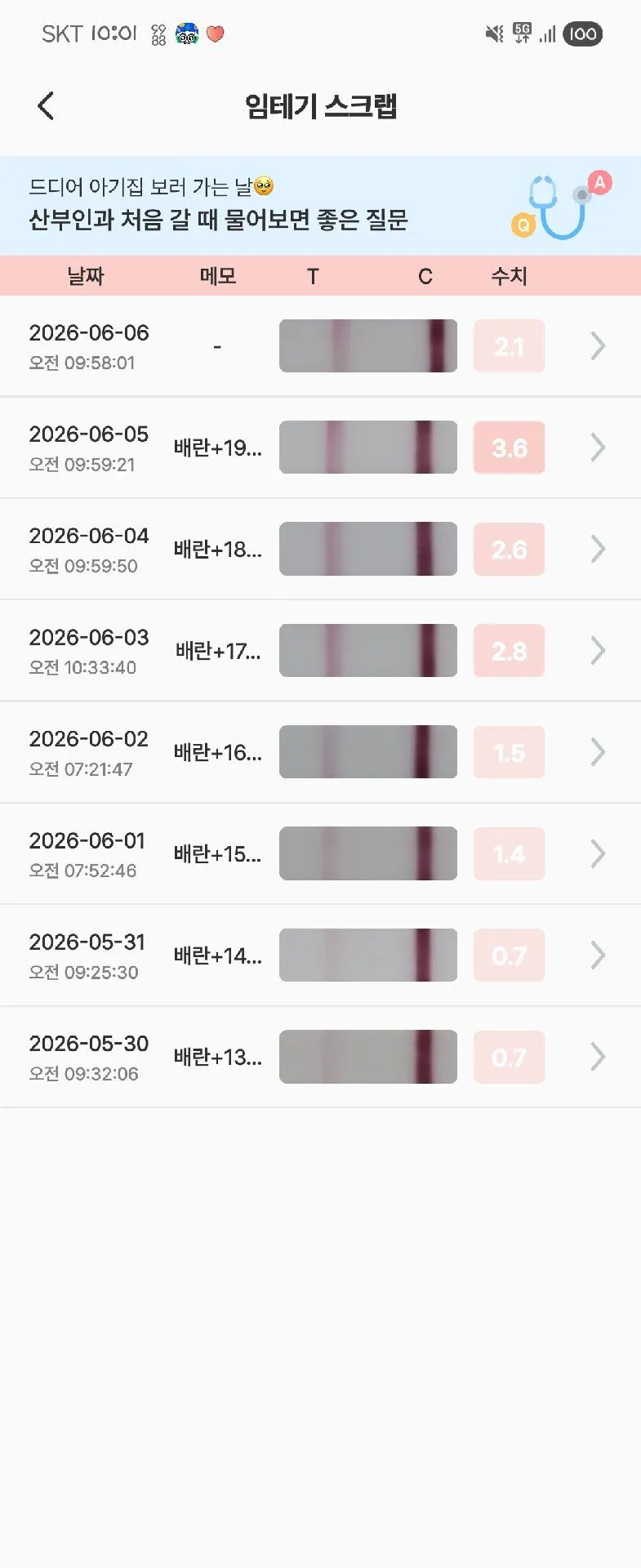 맘을 접고 있으려구요..