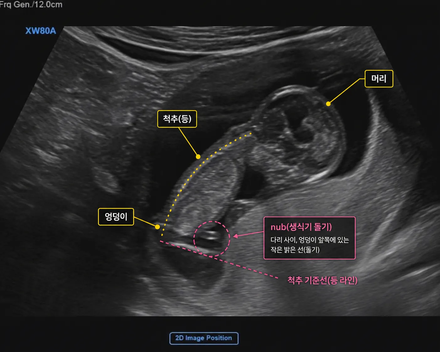 (12주2일) 초음파 성별 예측해주세요! 5