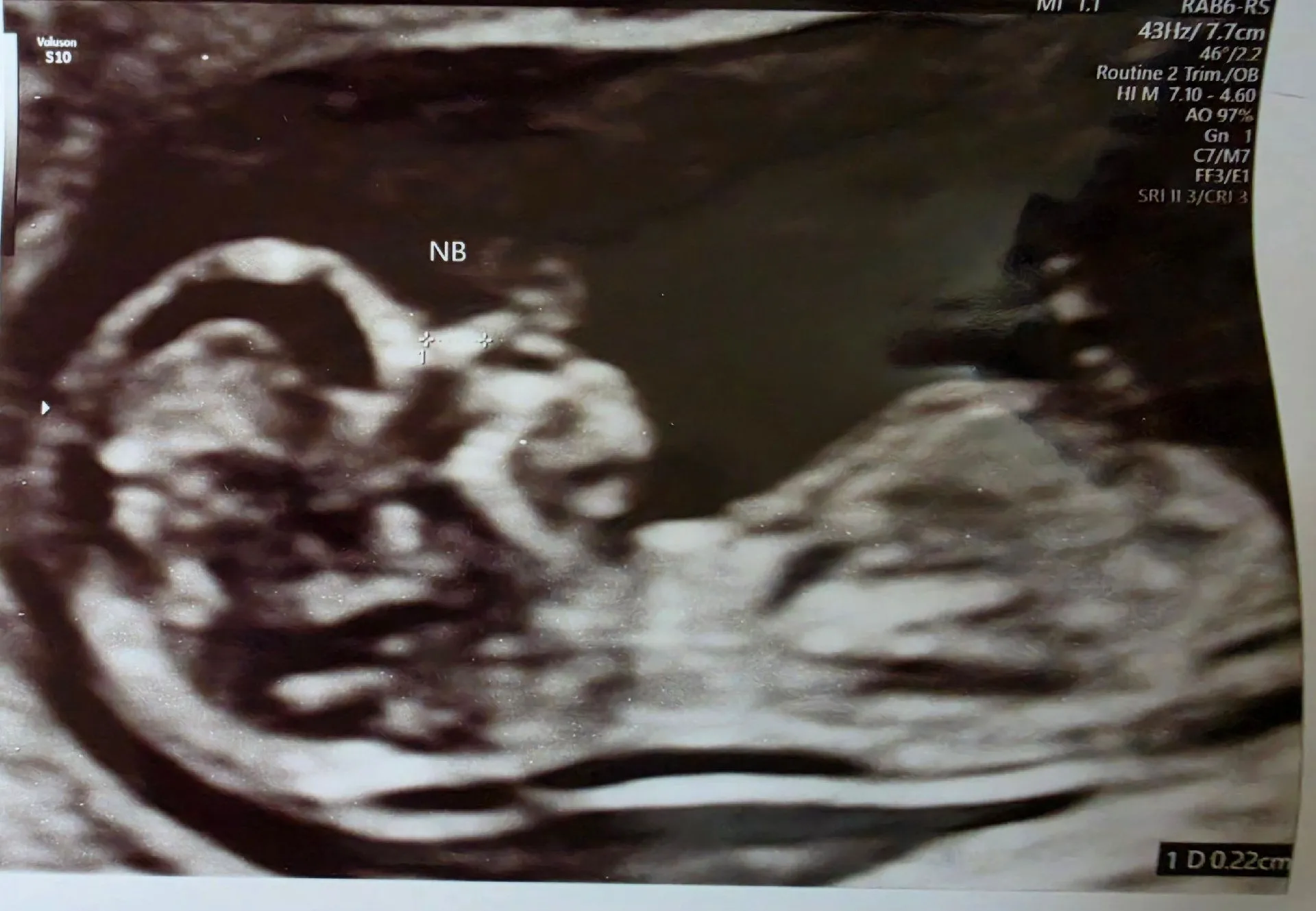 너무 귀여운 11주 아가 👶 1