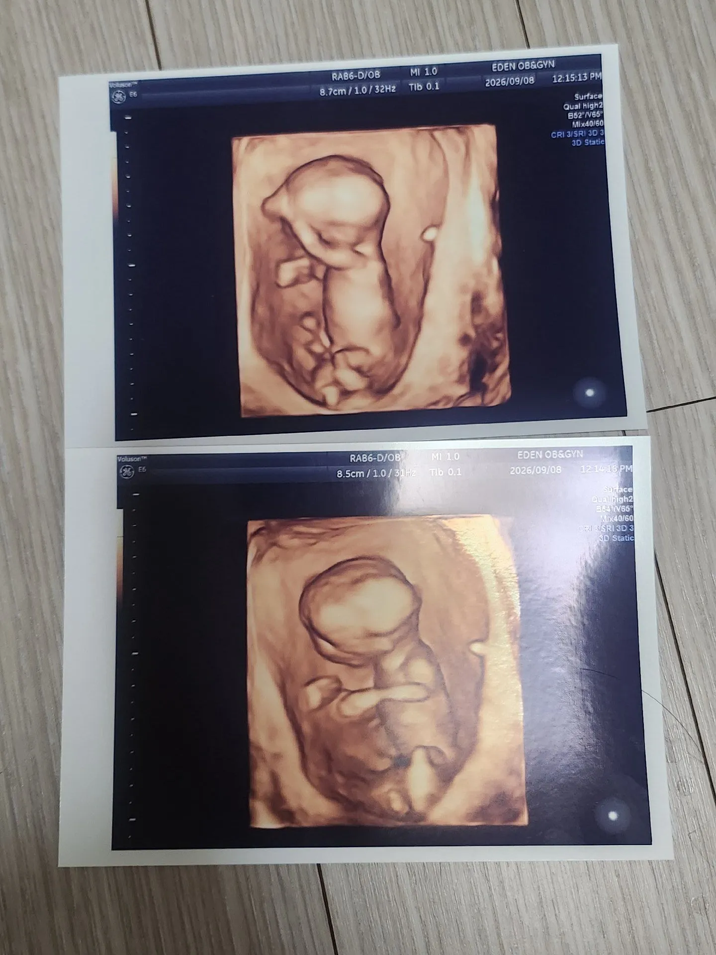 13주차 성별 추측해주세요 ! 1