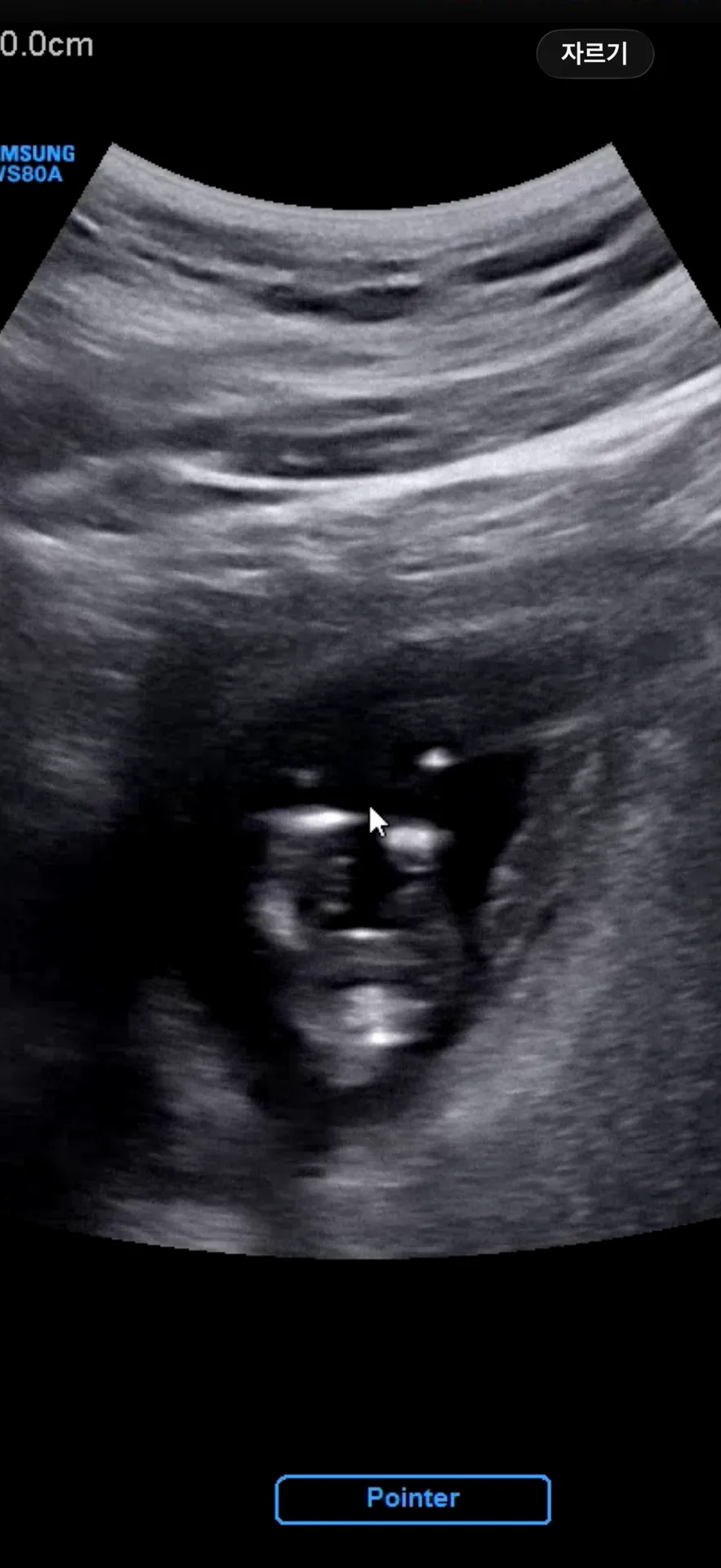 13주3일 각도법봐주세요오 🍼 3