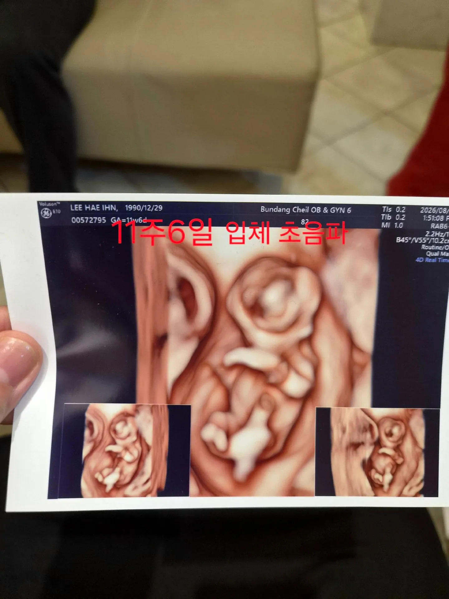 오늘 1차입체 초음파 찍고왔어요~ 1