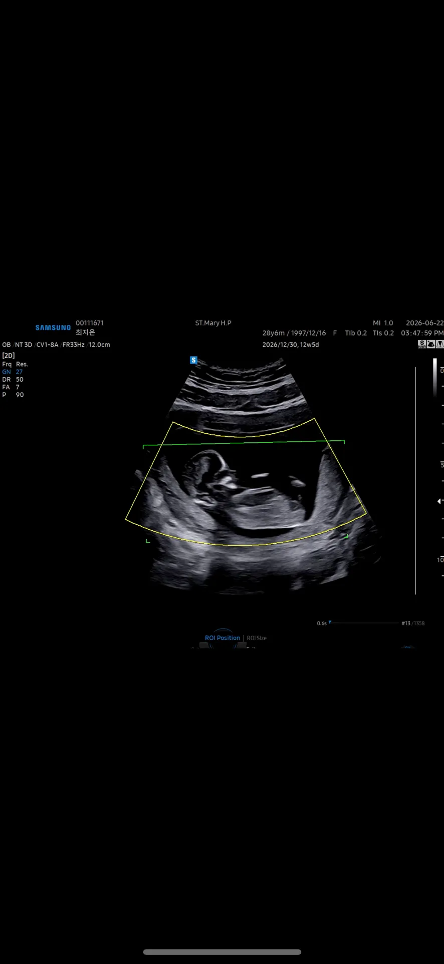 community post image