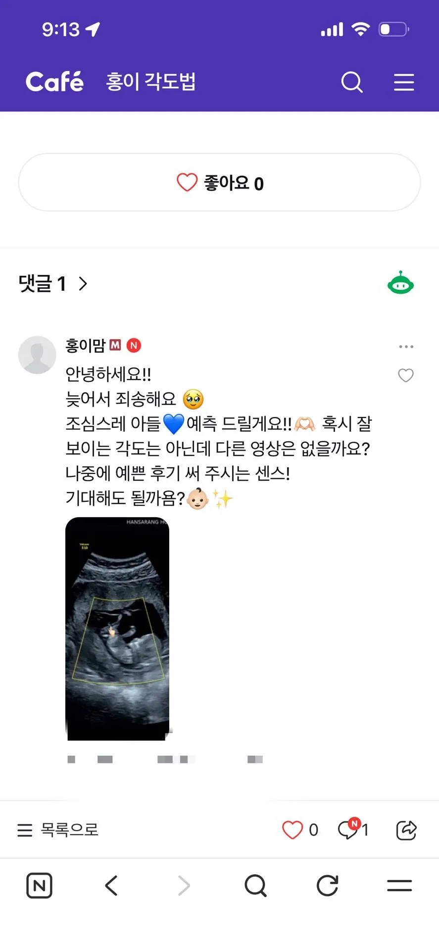 장꾸맘 홍이맘 각도법 반전 후기 공유해요 ㅎㅎ 1