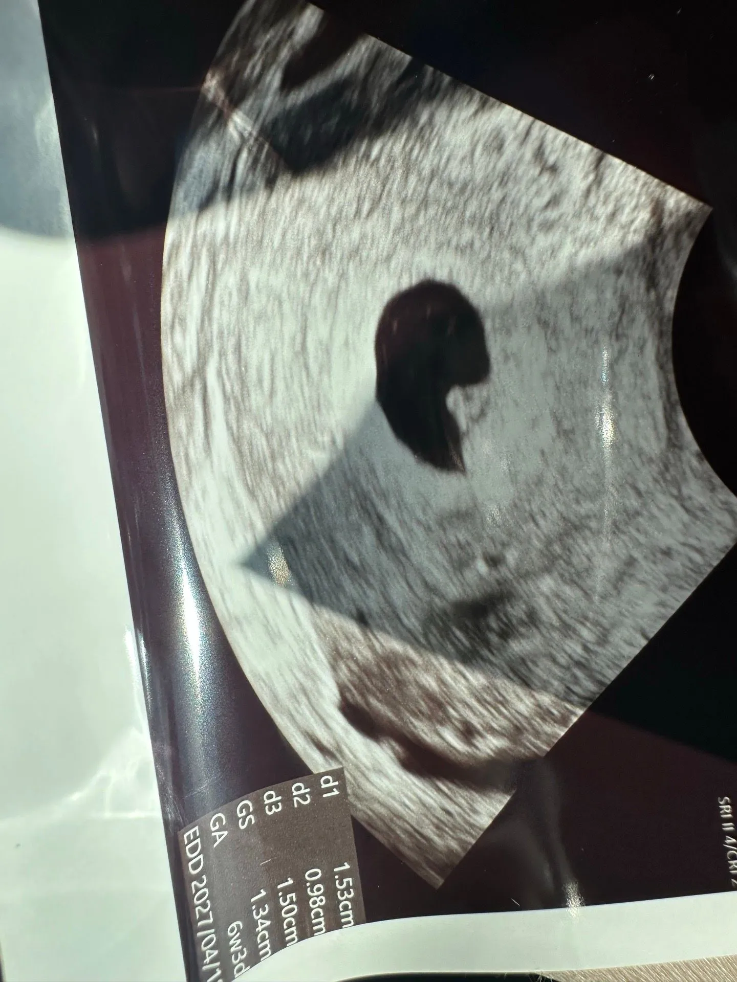 난황이 뚜렸하게 안보인대요 ㅠㅠ