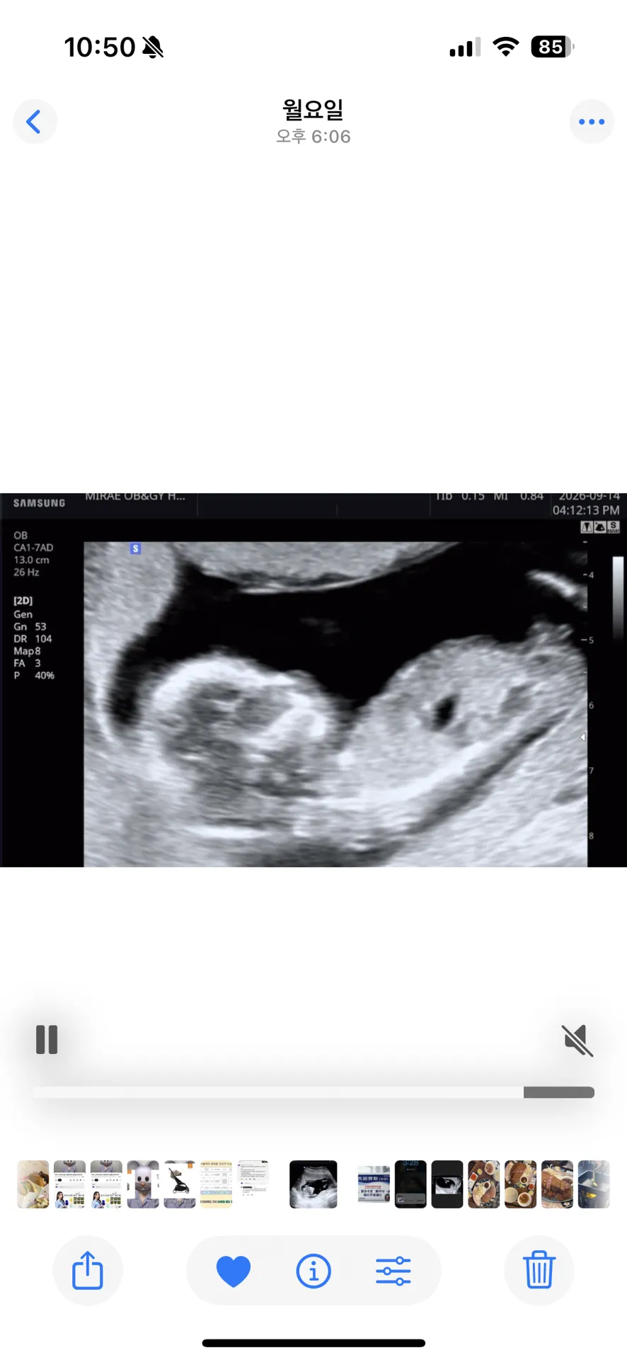 12주6일 성별 각도법 잘 보시는 분 계실까요 ?? 4