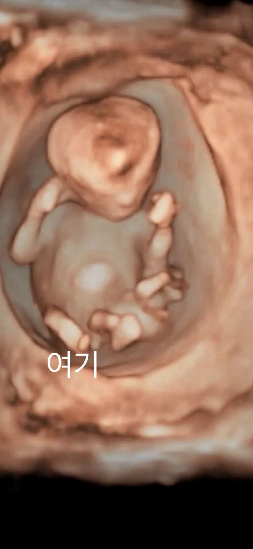 입초로는 원래 다 이렇게 보이나염.!? 1