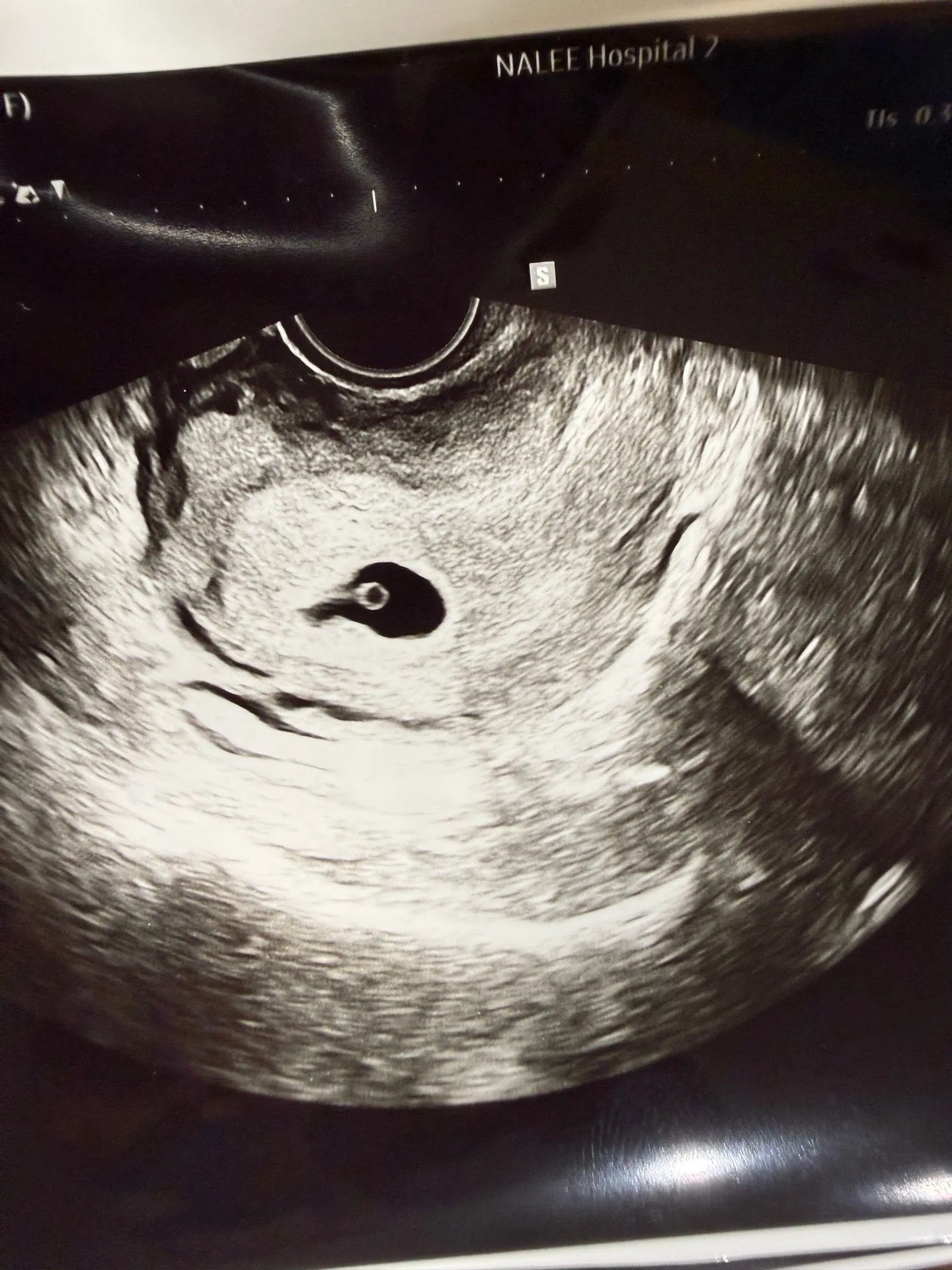 아기싹이 보이나요?  2